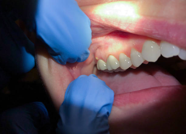 Emergency Dentist for Kids in OR